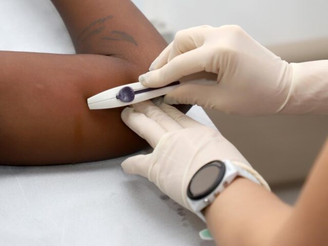 Adesão ao implante anticoncepcional cresce 553% em Campinas